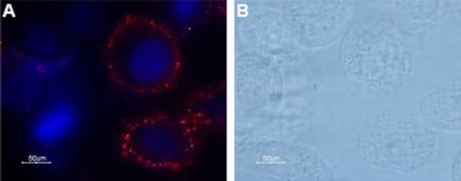 PAR1 (F2R) (extracellular) Antibody in Immunocytochemistry (ICC/IF)