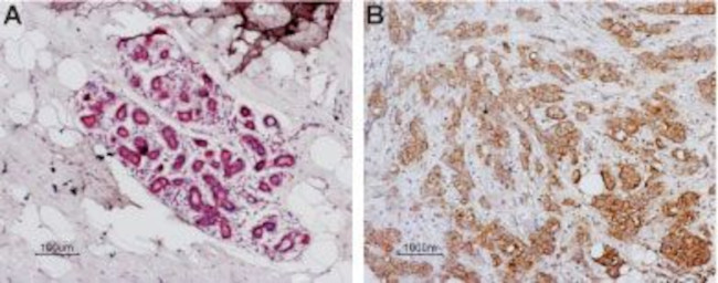 PAR1 (F2R) (extracellular) Antibody in Immunohistochemistry (Paraffin) (IHC (P))