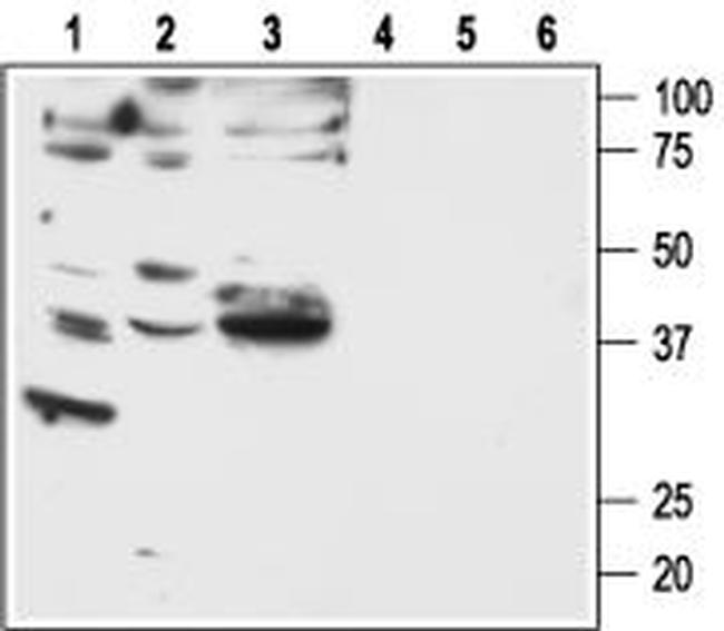 PAR2 (F2RL1) Antibody in Western Blot (WB)