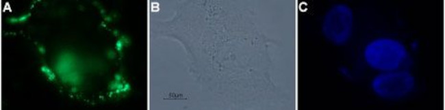 PAR4 (F2RL3) (extracellular) Antibody in Immunocytochemistry (ICC/IF)