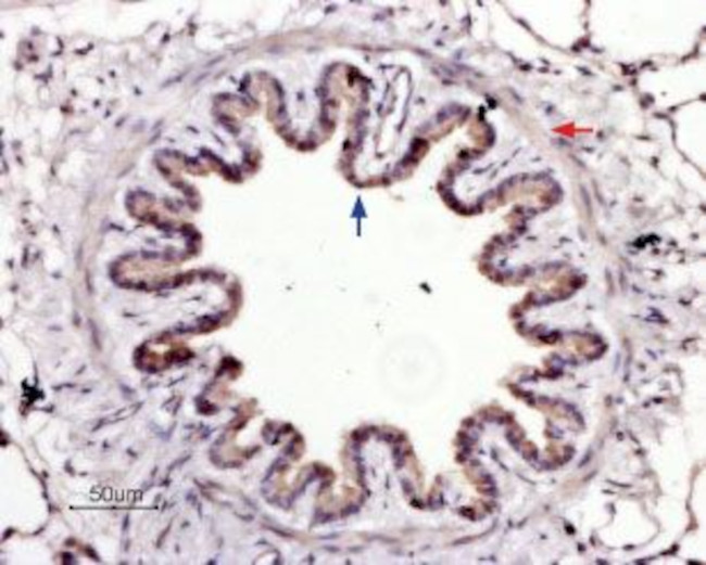 PAR4 (F2RL3) (extracellular) Antibody in Immunohistochemistry (Paraffin) (IHC (P))