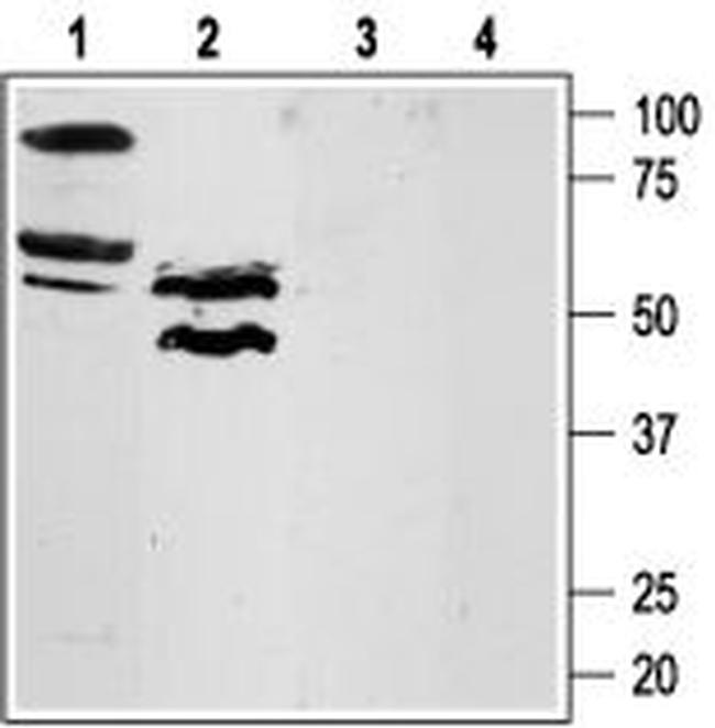 PAR4 (F2RL3) (extracellular) Antibody in Western Blot (WB)