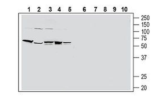 PAR2/F2RL1 (extracellular) Antibody in Western Blot (WB)