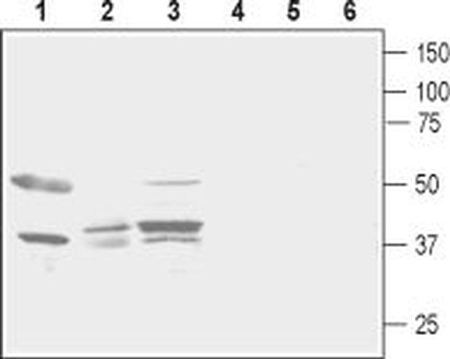 Prostaglandin E Receptor EP2/PTGER2 (extracellular) Antibody in Western Blot (WB)