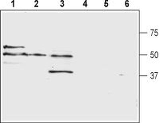 Prostaglandin E Receptor EP2/PTGER2 (extracellular) Antibody in Western Blot (WB)