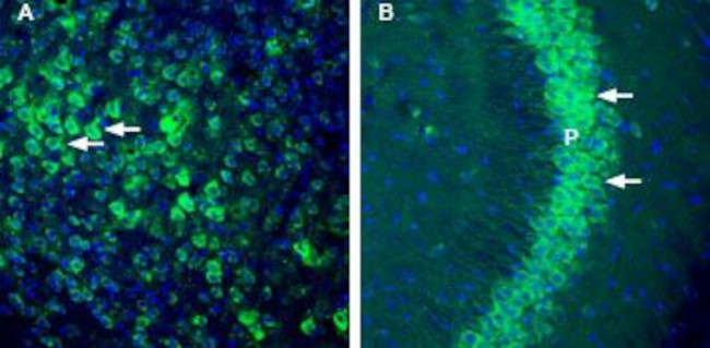 Thromboxane A2 Receptor Antibody in Immunohistochemistry (Frozen) (IHC (F))