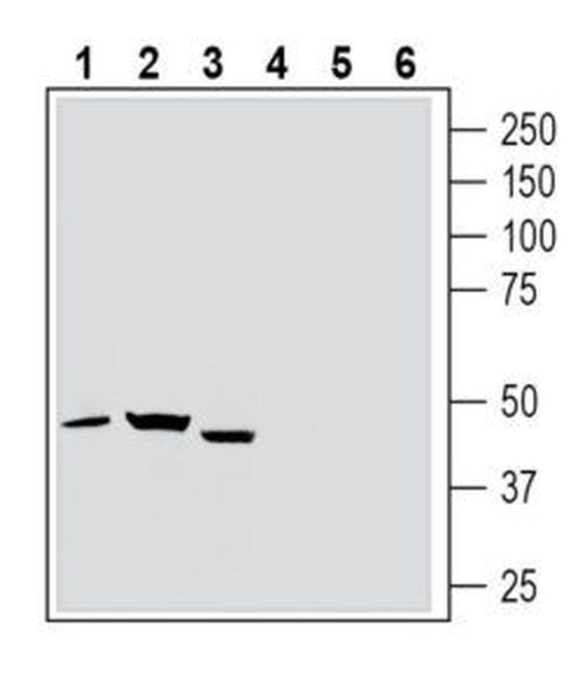 Thromboxane A2 Receptor (extracellular) Antibody in Western Blot (WB)