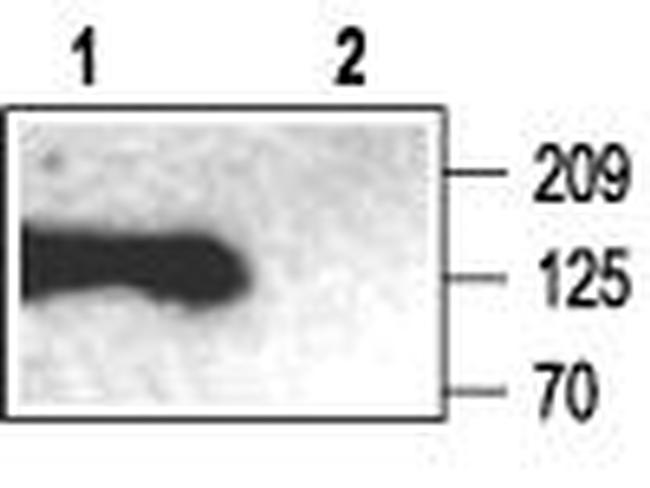 SAP102 Antibody in Western Blot (WB)