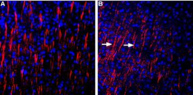 Shank3 Antibody in Immunohistochemistry (Frozen) (IHC (F))