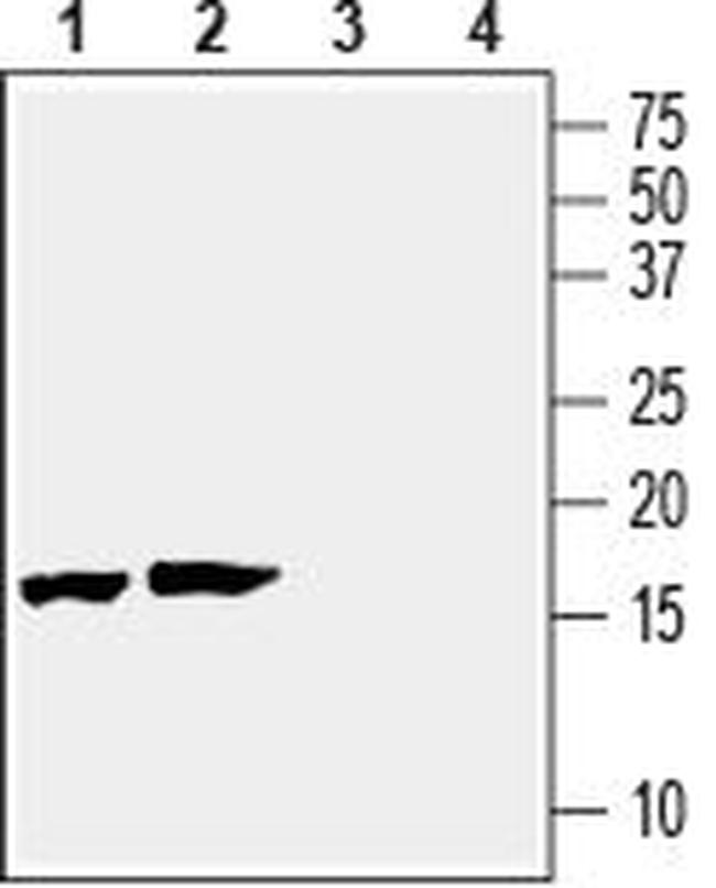 Beta-Synuclein Antibody in Western Blot (WB)