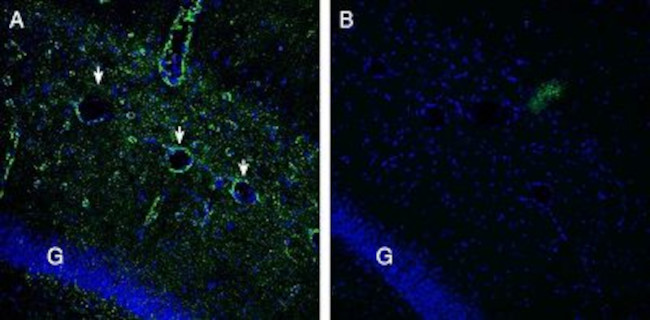 Gamma-Synuclein Antibody in Immunohistochemistry (Frozen) (IHC (F))