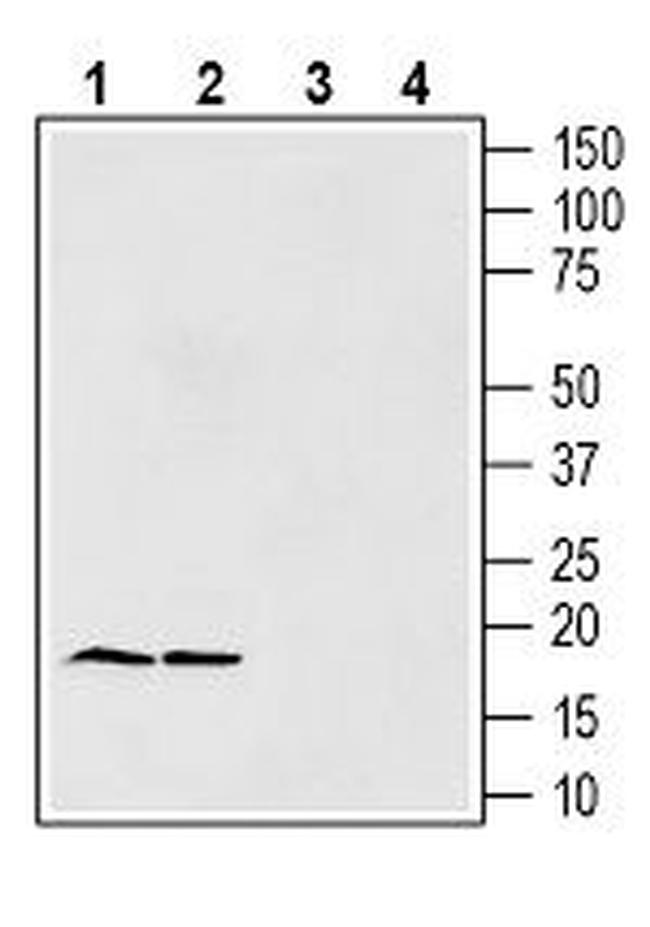 Gamma-Synuclein Antibody in Western Blot (WB)