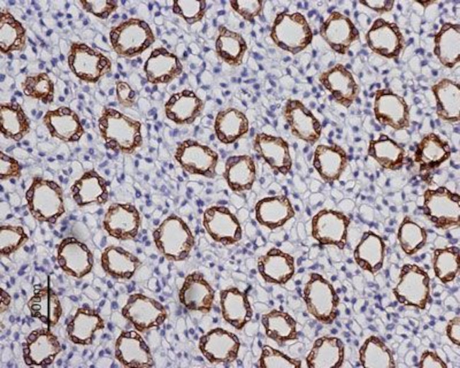 Aquaporin 2 Antibody in Immunohistochemistry (Paraffin) (IHC (P))