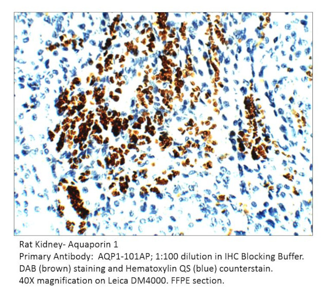 Aquaporin 1 Antibody in Immunohistochemistry (IHC)