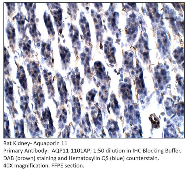 Aquaporin 11 Antibody in Immunohistochemistry (IHC)