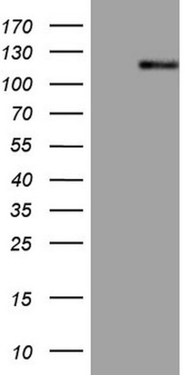 AR Antibody in Western Blot (WB)