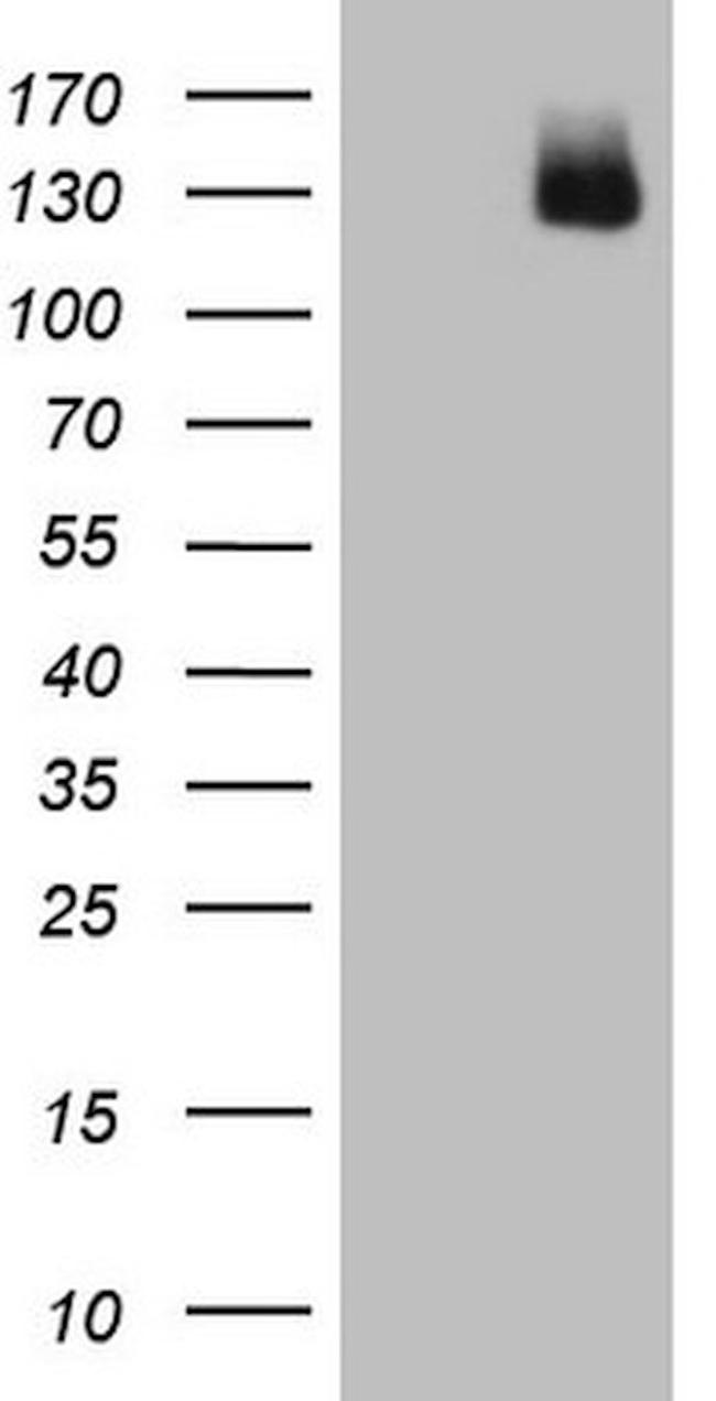 AR Antibody in Western Blot (WB)