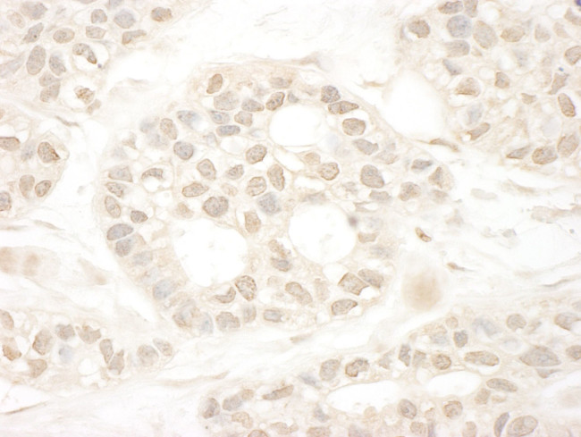 ARA70 Antibody in Immunohistochemistry (IHC)