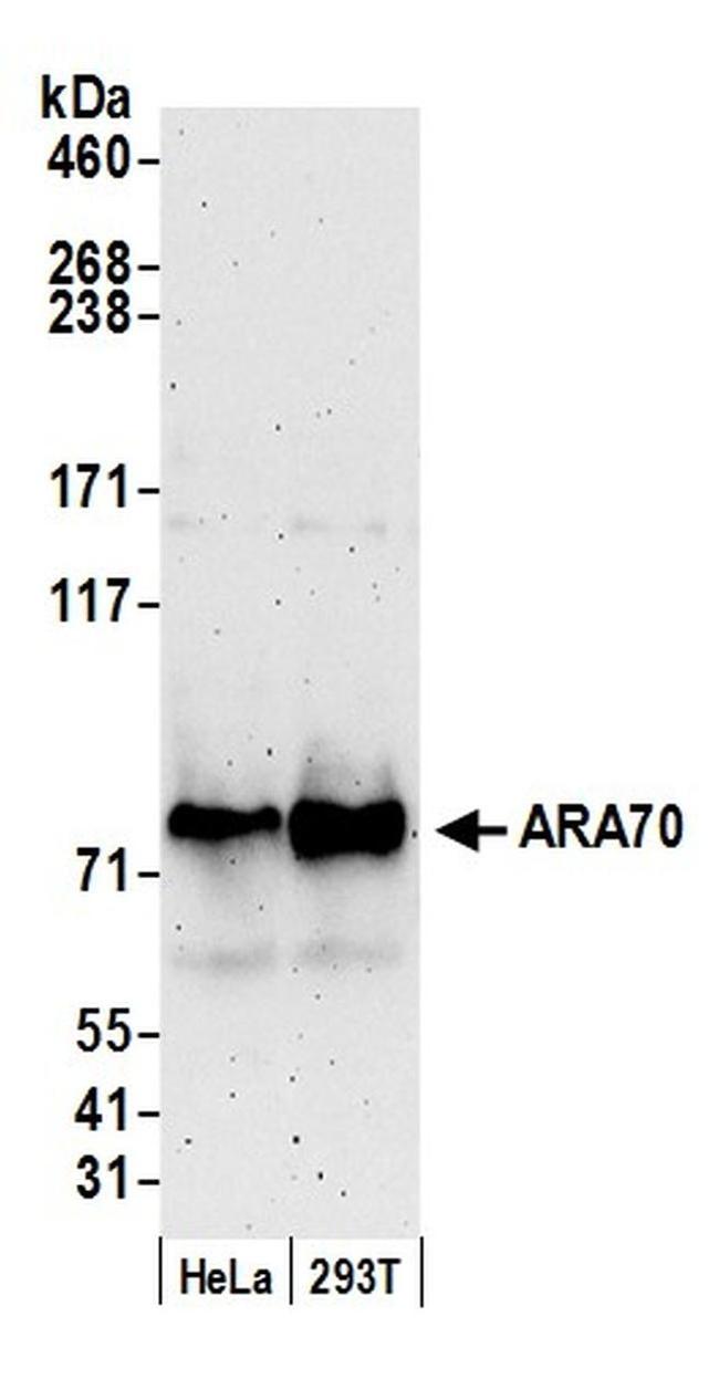 ARA70 Antibody in Western Blot (WB)