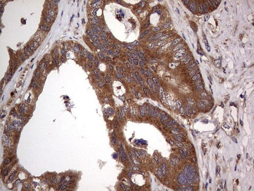 ARAF Antibody in Immunohistochemistry (Paraffin) (IHC (P))