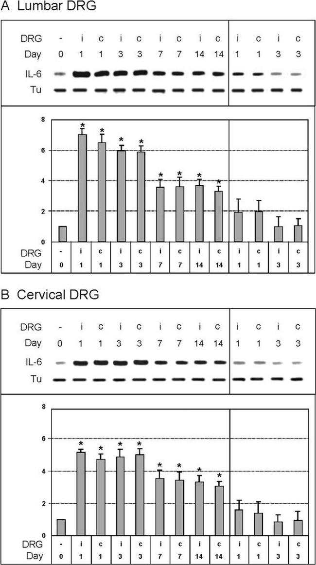 IL-6 Antibody in Western Blot (WB)