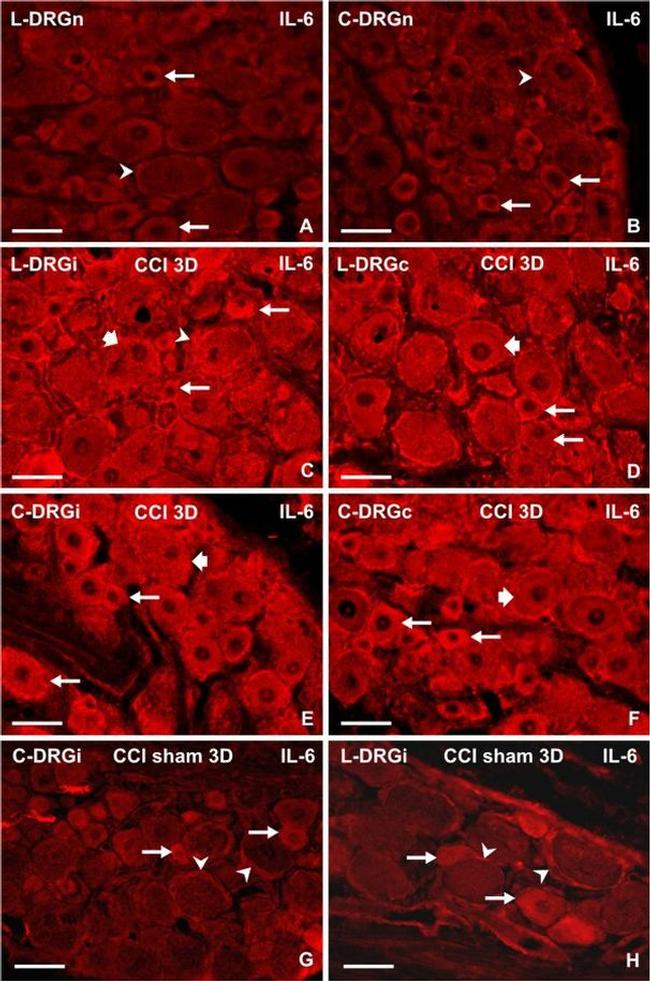 IL-6 Antibody in Immunohistochemistry (IHC)