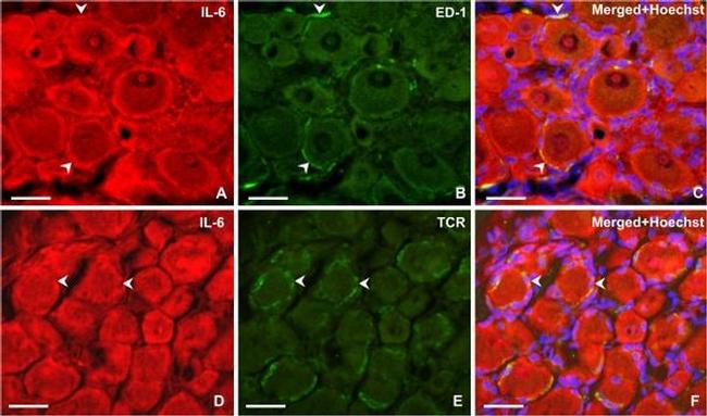 IL-6 Antibody in Immunohistochemistry (IHC)