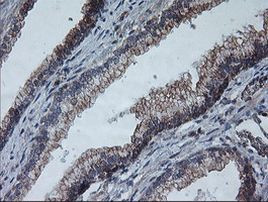 ARCN1 Antibody in Immunohistochemistry (Paraffin) (IHC (P))