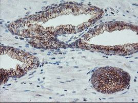 ARCN1 Antibody in Immunohistochemistry (Paraffin) (IHC (P))