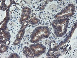 ARCN1 Antibody in Immunohistochemistry (Paraffin) (IHC (P))