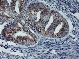 ARCN1 Antibody in Immunohistochemistry (Paraffin) (IHC (P))