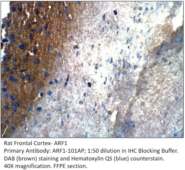 ARF1 Antibody in Immunohistochemistry (IHC)