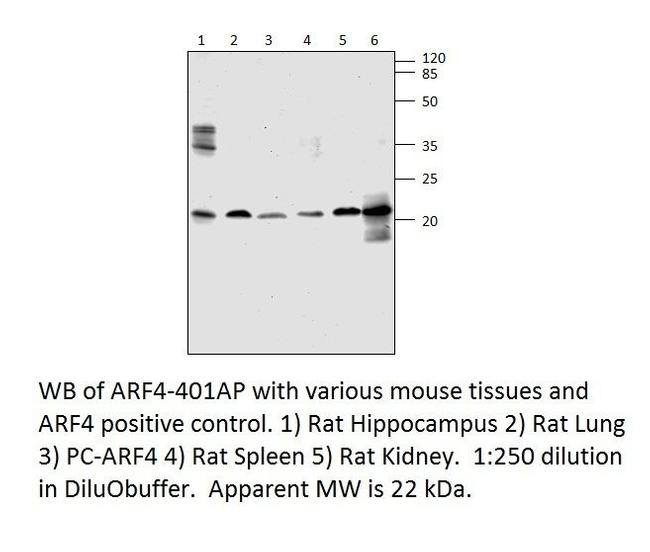 ARF4 Antibody in Western Blot (WB)