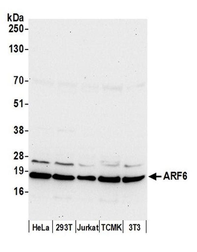 ARF6/ADP Ribosylation Factor 6 Antibody in Western Blot (WB)