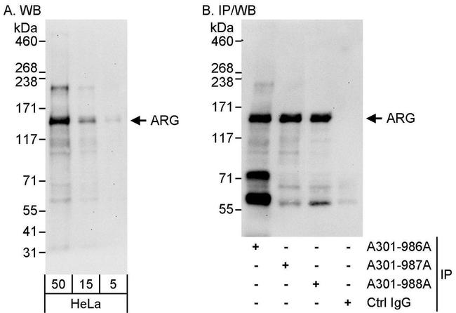 ARG Antibody in Western Blot (WB)