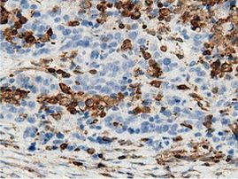 ARHGAP25 Antibody in Immunohistochemistry (Paraffin) (IHC (P))