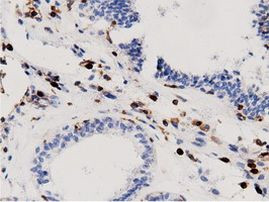 ARHGAP25 Antibody in Immunohistochemistry (Paraffin) (IHC (P))