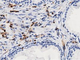 ARHGAP25 Antibody in Immunohistochemistry (Paraffin) (IHC (P))