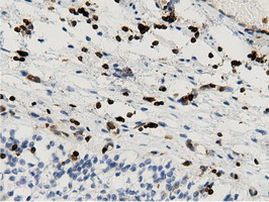 ARHGAP25 Antibody in Immunohistochemistry (Paraffin) (IHC (P))