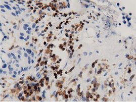 ARHGAP25 Antibody in Immunohistochemistry (Paraffin) (IHC (P))