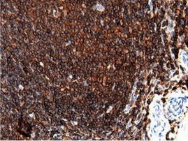 ARHGAP25 Antibody in Immunohistochemistry (Paraffin) (IHC (P))