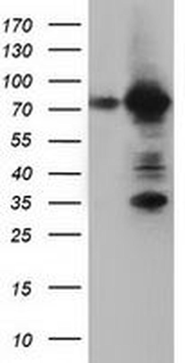 ARHGAP25 Antibody in Western Blot (WB)