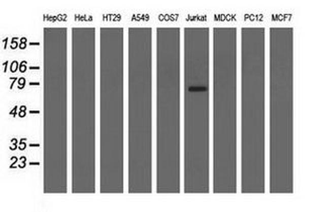 ARHGAP25 Antibody in Western Blot (WB)