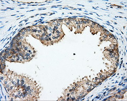 ARHGDIA Antibody in Immunohistochemistry (Paraffin) (IHC (P))