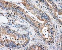 ARHGDIA Antibody in Immunohistochemistry (Paraffin) (IHC (P))