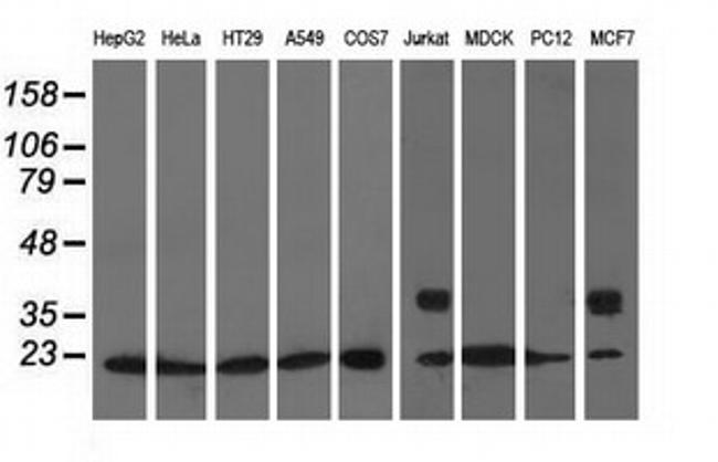 ARHGDIA Antibody in Western Blot (WB)