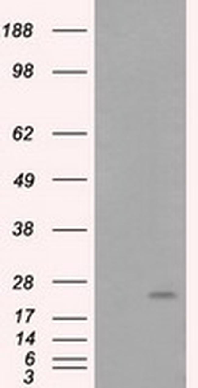 ARHGDIA Antibody in Western Blot (WB)