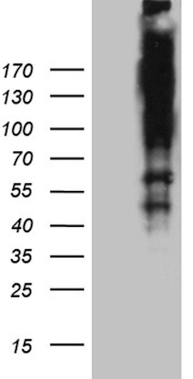 ARID1A Antibody in Western Blot (WB)