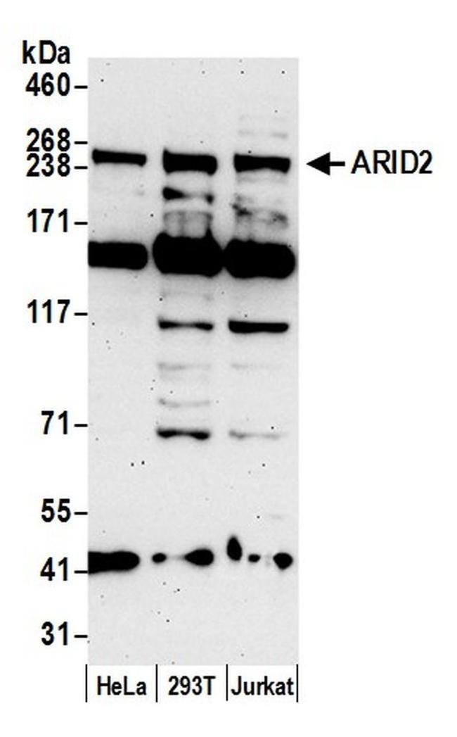 ARID2 Antibody in Western Blot (WB)