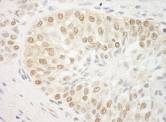 ARID3B Antibody in Immunohistochemistry (IHC)